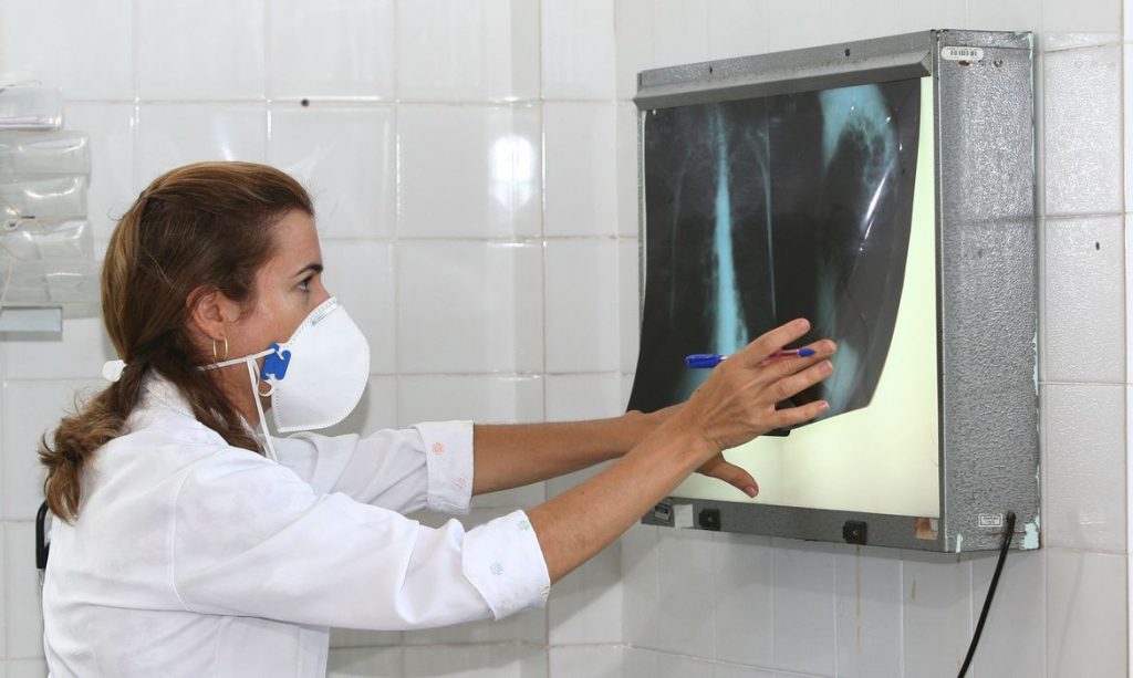 Governo cria comitê para eliminar a tuberculose