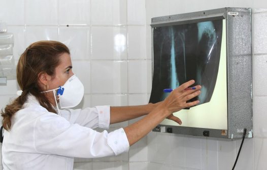 Governo cria comitê para eliminar a tuberculose