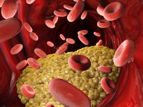 Colesterol e seus sinais de alerta